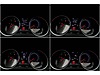 Vasıta / Otomobil / Volkswagen / Polo / 1.4 TDI / Comfortline