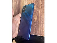 OMİX X300 TR HATASIZ #1282389870