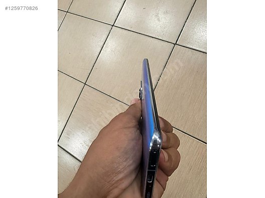 İkinci El ve Sıfır Alışveriş / Cep Telefonu & Aksesuar / Cep Telefonu / Xiaomi / Mi 11