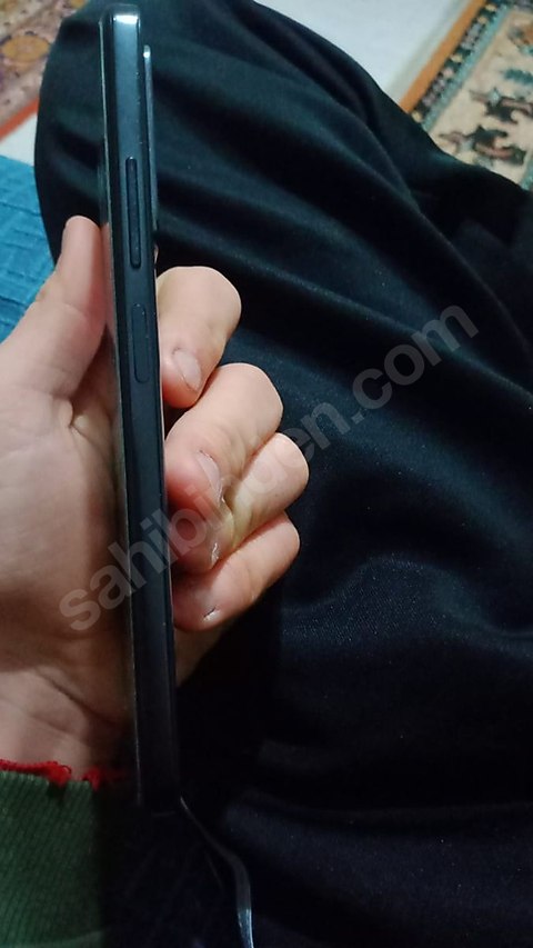 REDMİ NOTE 11 ACİL SATILIK